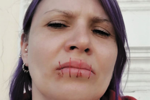 With Mouths Sewn Shut